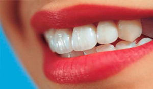 7 Types of Cosmetic Dentistry Procedures